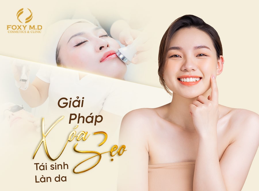 Điều Trị Sẹo Rỗ Đà Nẵng: Foxy Là Lựa Chọn Tốt Nhất Cho Làn Da Sạch Mịn